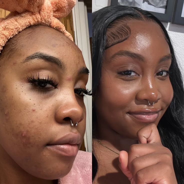 Follow_these_steps_to_clear_skin.jpg