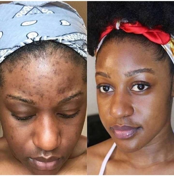 How_To_Get_Rid_Of_Dark_Spots_On_Your_Arms.jpg